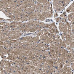 Pyruvate Dehydrogenase Phosphatase/PDP1/PPM2C Antibody, Novus Biologicals